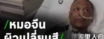 ตะลึง! หมอจีนป่วย โควิด-19 ผิวหนังเปลี่ยนสี | Thairath Online